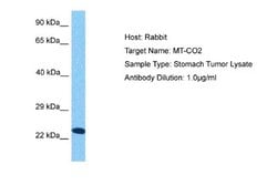 MT-CO2 Antibody, Novus Biologicals 100 &mu;L; Unconjugated:Antibodies,